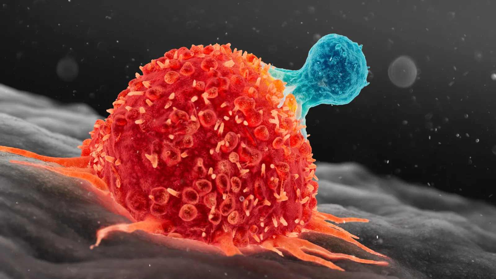 Study Finds Type 1 Diabetes May Boost Immune Cells to Fight Certain Cancers